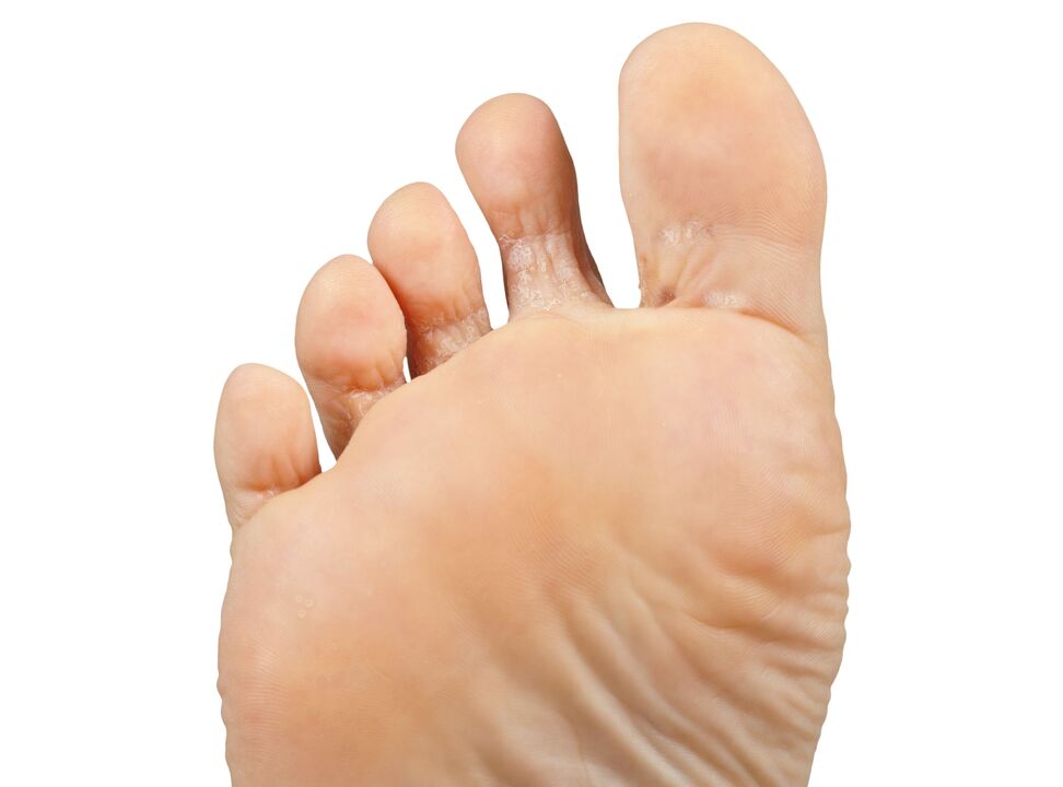 Demyxil con la crema funer-and-pair-e-ettica