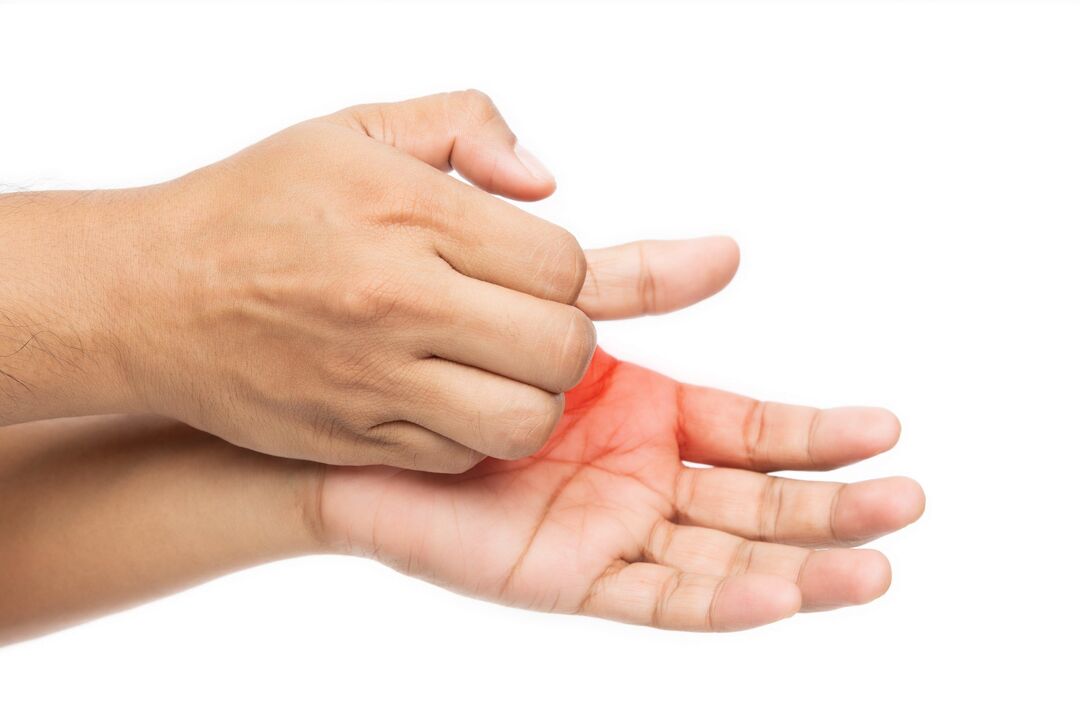 Prurito con un fungo e il suo trattamento con zxcvbnmqwert -creen con crema